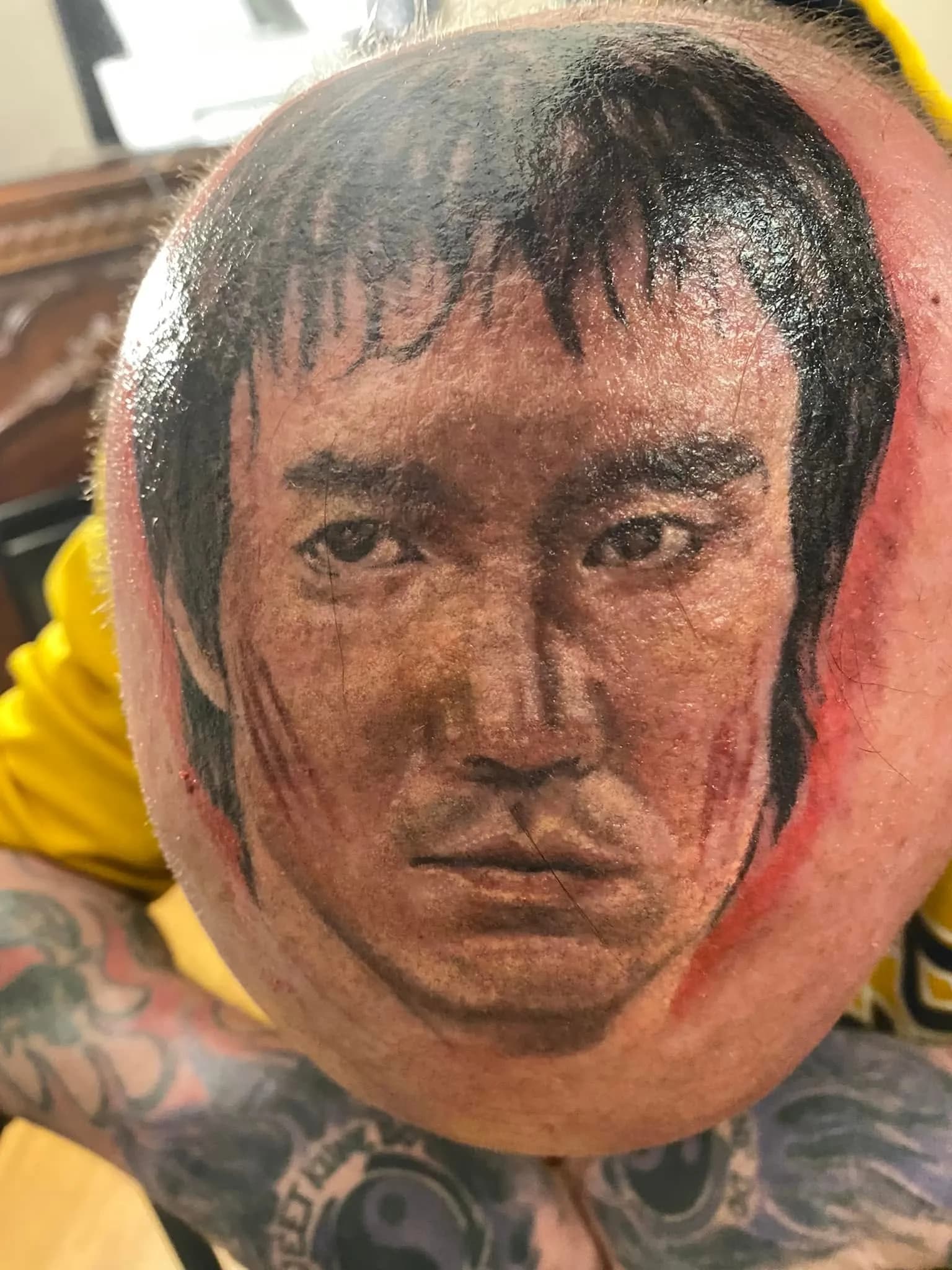 Same scalp portrait, closer crop