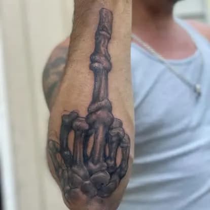 Same skeletal hand, second angle
